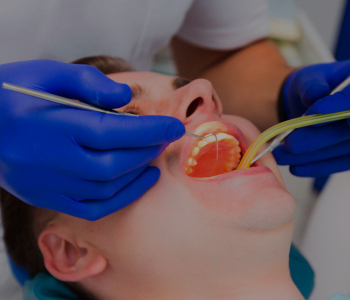 Soins des caries au laser
